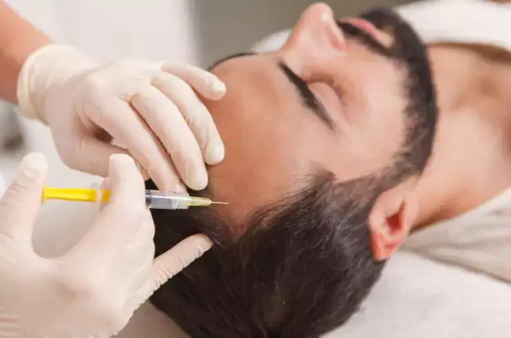 stardermclinic-microneedling-and-prp-therapy-